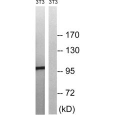 兔抗MERTKTYRO3(Phospho-Tyr749681)多克隆抗體