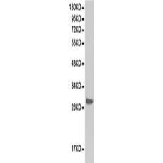 兔抗PRSS1多克隆抗體