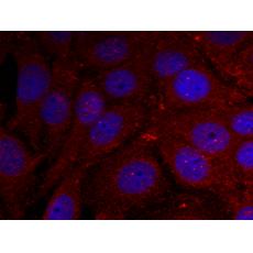 兔抗SNCA (Phospho-Tyr136)多克隆抗體