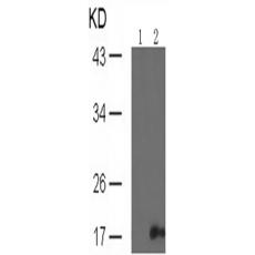 兔抗SNCA (Phospho-Tyr136)多克隆抗體