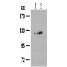 兔抗PRKD1 (Phospho-Ser738)多克隆抗體