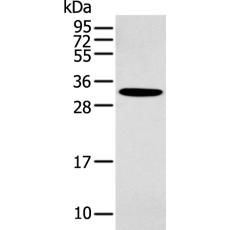 兔抗NANOS1多克隆抗體