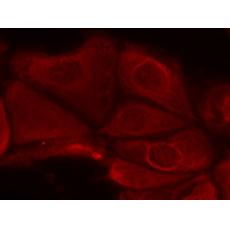 兔抗RPS6KB1 (Phospho-Ser411)多克隆抗體    