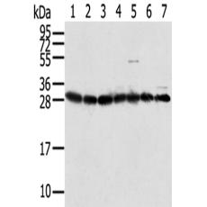 兔抗RPS3多克隆抗體 