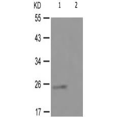 兔抗TK1(Phospho-Ser13) 多克隆抗體 