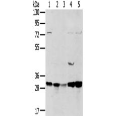  兔抗TPD52L2多克隆抗體 