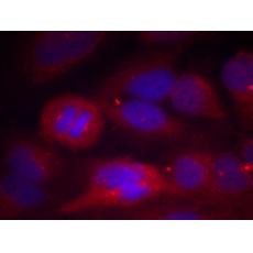 兔抗TH(Phospho-Ser40) 多克隆抗體 