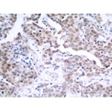  兔抗TP53 (Phospho-Ser15)多克隆抗體    