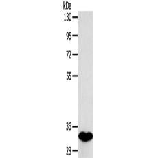 兔抗SULT1B1多克隆抗體