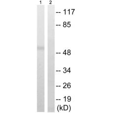 兔抗TUBA1/3/4(Phospho-Tyr272) 多克隆抗體 