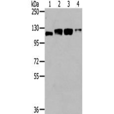 兔抗UBA1多克隆抗體